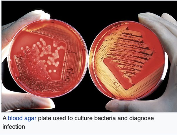 Read more about the article Bachelor of Science in Microbiology (B.Sc – Microbiology) 08￼