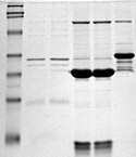 Bachelor of Science Microbiology (CBM) – Chemistry, Botany, Microbiology 09 3 125px SDS PAGE