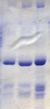 Bachelor of Science Microbiology (CBM) – Chemistry, Botany, Microbiology 09 4 73px Coomassie blue stained gel