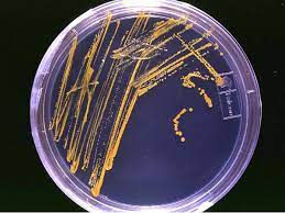 Read more about the article Bachelor of Science Microbiology (CBM) – Chemistry, Botany, Microbiology 01