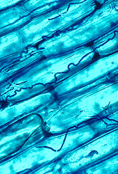 170px Neotyphodium coenophialum