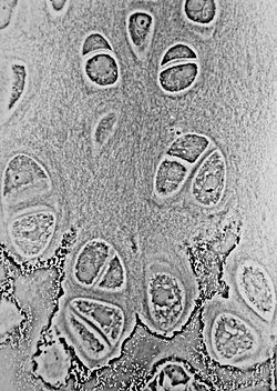 Bachelor of Science Microbiology (CBM) – Chemistry, Botany, Microbiology Smart Boy 4 250px Hypertrophic Zone of Epiphyseal Plate 1