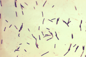 Read more about the article Clostridium perfringens